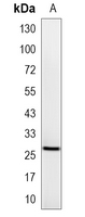 1 - Recombinant Anti-IPP1 Rabbit mAb AP94976