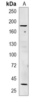 1 - Recombinant Anti-CD136 Rabbit mAb AP94978