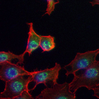 3 - Recombinant Anti-S100-A4 Rabbit mAb AP94979