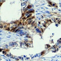 19 - Recombinant Anti-S100-A4 Rabbit mAb AP94979