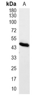 1 - Recombinant Anti-E2F2 Rabbit mAb AP94980
