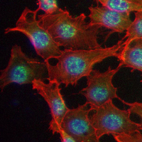 3 - Recombinant Anti-IRF5 Rabbit mAb AP94981
