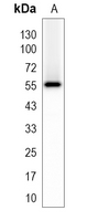 1 - Recombinant Anti-IRF5 Rabbit mAb AP94981