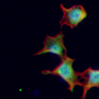 3 - Recombinant Anti-CDK6 Rabbit mAb AP94983