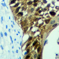 19 - Recombinant Anti-CDK6 Rabbit mAb AP94983