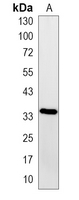 1 - Recombinant Anti-CDK6 Rabbit mAb AP94983