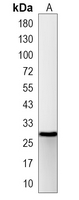 1 - Recombinant Anti-14-3-3 gamma Rabbit mAb AP94986