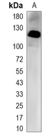1 - Recombinant Anti-HDAC7 Rabbit mAb AP94988