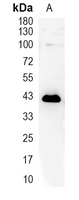 1 - Recombinant Anti-HDAC8 Rabbit mAb AP94989