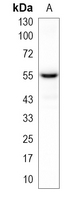 1 - Recombinant Anti-PAX7 Rabbit mAb AP94991