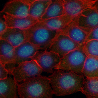 3 - Recombinant Anti-MEKK3 Rabbit mAb AP94993