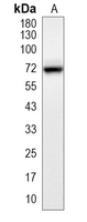 1 - Recombinant Anti-MEKK3 Rabbit mAb AP94993