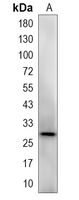 1 - Recombinant Anti-14-3-3 theta/tau Rabbit mAb AP94995