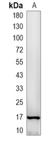 1 - Recombinant Anti-HSP20 (Phospho-S16) Rabbit mAb AP94998