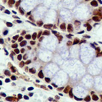 19 - Recombinant Anti-Sororin Rabbit mAb AP94999
