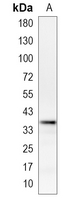 1 - Recombinant Anti-Sororin Rabbit mAb AP94999