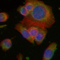 3 - Recombinant Anti-A-RAF Rabbit mAb AP95000