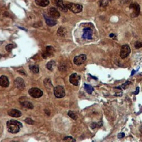 19 - Recombinant Anti-Ubiquitin Rabbit mAb AP95001