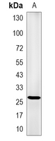 1 - Recombinant Anti-Ubiquitin Rabbit mAb AP95001