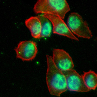 3 - Recombinant Anti-TSG101 Rabbit mAb AP95003