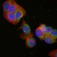 3 - Recombinant Anti-Peroxiredoxin 2 Rabbit mAb AP95004