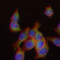 3 - Recombinant Anti-JAK2 (Phospho-Y1007/Y1008) Rabbit mAb AP95005
