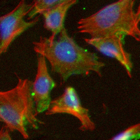 3 - Recombinant Anti-LYN (Phospho-Y396) Rabbit mAb AP95006