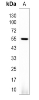1 - Recombinant Anti-LYN (Phospho-Y396) Rabbit mAb AP95006