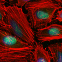 3 - Recombinant Anti-DUSP1 Rabbit mAb AP95007