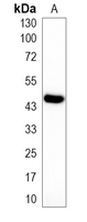 1 - Recombinant Anti-DUSP1 Rabbit mAb AP95007