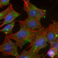 3 - Recombinant Anti-CD247 Rabbit mAb AP95008