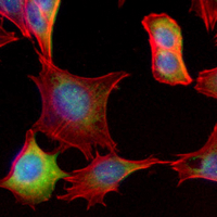 3 - Recombinant Anti-Thymidine Kinase 1 Rabbit mAb AP95010