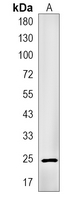 1 - Recombinant Anti-Thymidine Kinase 1 Rabbit mAb AP95010