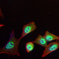 3 - Recombinant Anti-Gamma-catenin Rabbit mAb AP95011