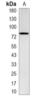 1 - Recombinant Anti-Gamma-catenin Rabbit mAb AP95011