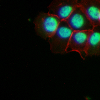 3 - Recombinant Anti-S100-A6 Rabbit mAb AP95012