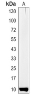 1 - Recombinant Anti-S100-A6 Rabbit mAb AP95012