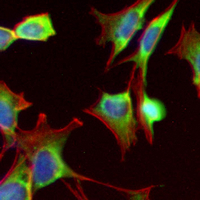 3 - Recombinant Anti-Neutrophil Elastase Rabbit mAb AP95013