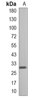 1 - Recombinant Anti-Neutrophil Elastase Rabbit mAb AP95013