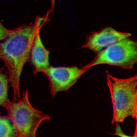3 - Recombinant Anti-PDHA1 Rabbit mAb AP95014