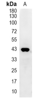 1 - Recombinant Anti-PDHA1 Rabbit mAb AP95014