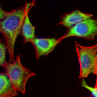 3 - Recombinant Anti-SERCA2 Rabbit mAb AP95016