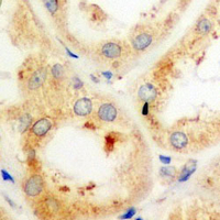 19 - Recombinant Anti-SERCA2 Rabbit mAb AP95016