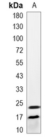 1 - Recombinant Anti-FGF2 Rabbit mAb AP95017