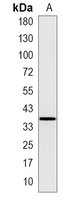 1 - Recombinant Anti-CD74 Rabbit mAb AP95019