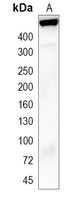 1 - Recombinant Anti-Apolipoprotein B Rabbit mAb AP95020
