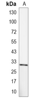 1 - Recombinant Anti-NQO1 Rabbit mAb AP95021