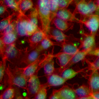 3 - Recombinant Anti-Phospho-Tyrosine Rabbit mAb AP95022