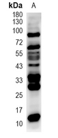 1 - Recombinant Anti-Phospho-Tyrosine Rabbit mAb AP95022