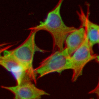 3 - Recombinant Anti-Annexin A5 Rabbit mAb AP95023